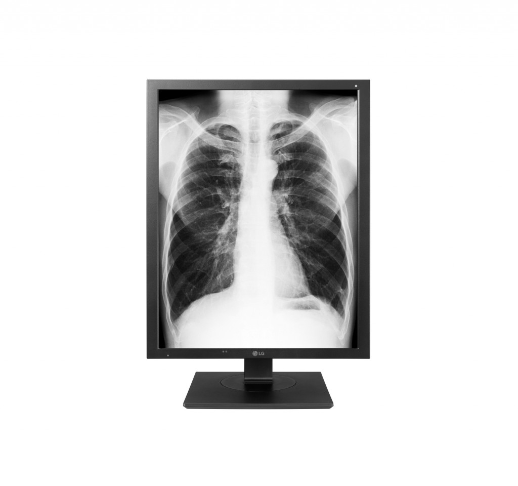 A front view of the LG Diagnostic Monitor model 21HK512D displaying an X-ray of a person’s chest.