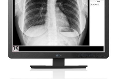 A front view of LG Clinical Review Monitor model 19HK312C displaying an X-ray of a person’s chest