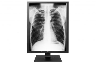 A front view of the LG Diagnostic Monitor model 21HK512D displaying an X-ray of a person’s chest