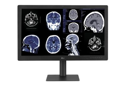 Medical images display on LG Diagnostic Monitor 32HQ713D