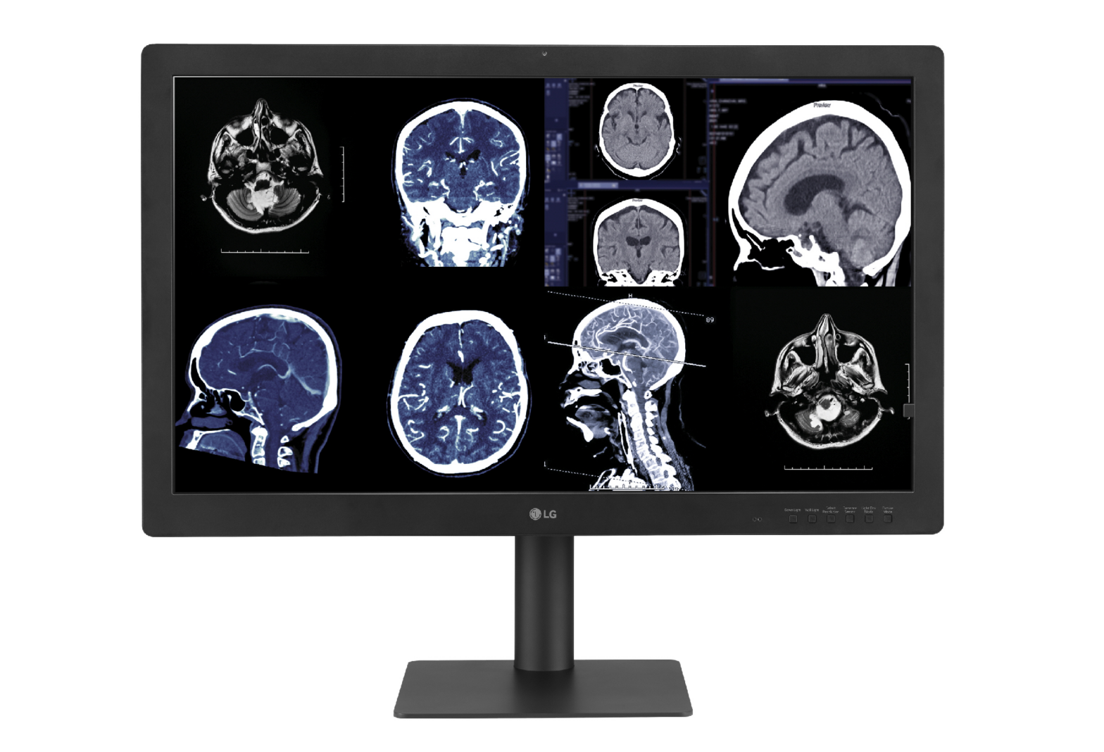 Medical images display on LG Diagnostic Monitor 32HQ713D