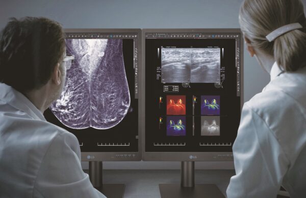 Doctor looking at images displayed on LG’s diagnostic monitor